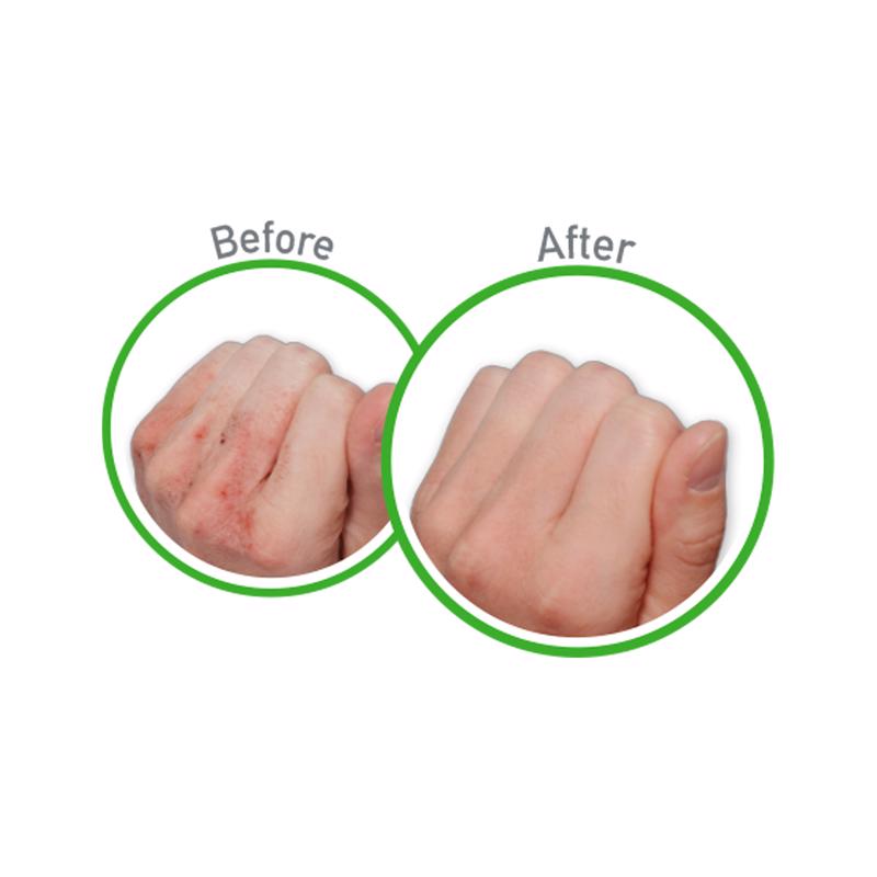 O'Keefe's Working Hands Hand Cream before and after of knuckles.