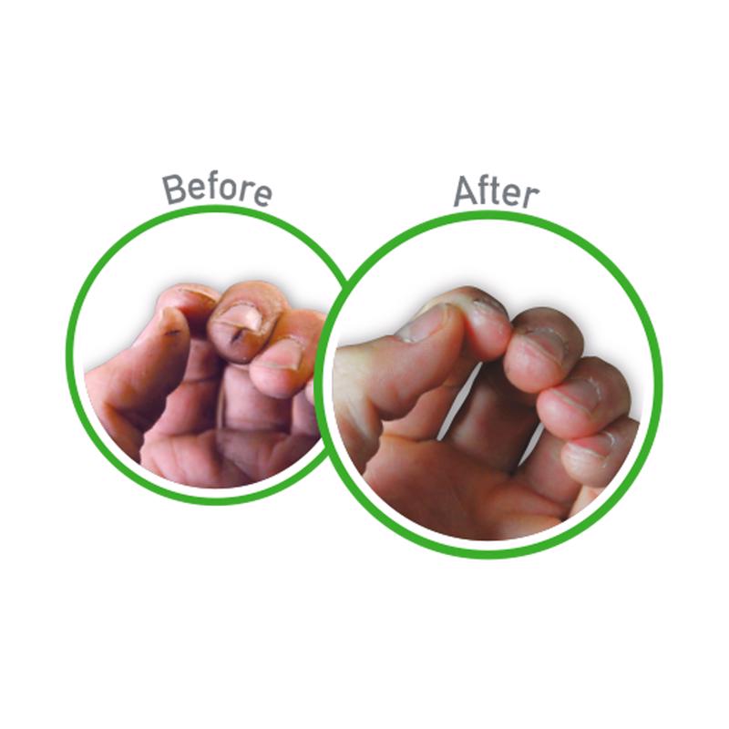 O'Keefe's Working Hands Hand Cream before and after image of tips of fingers.